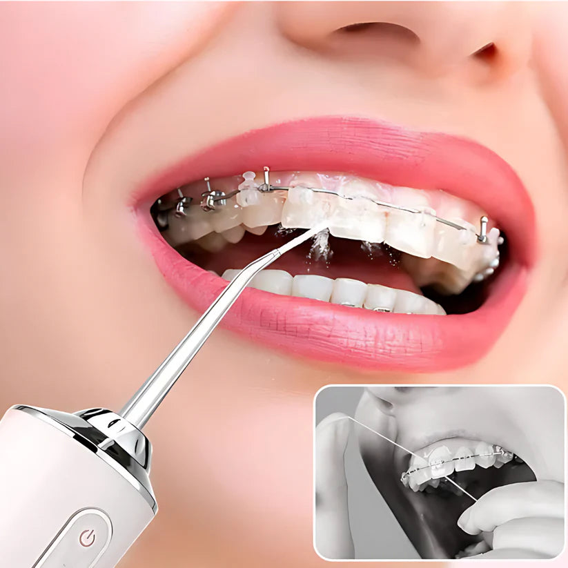 Hydro Clean Pro – Irrigador Dental